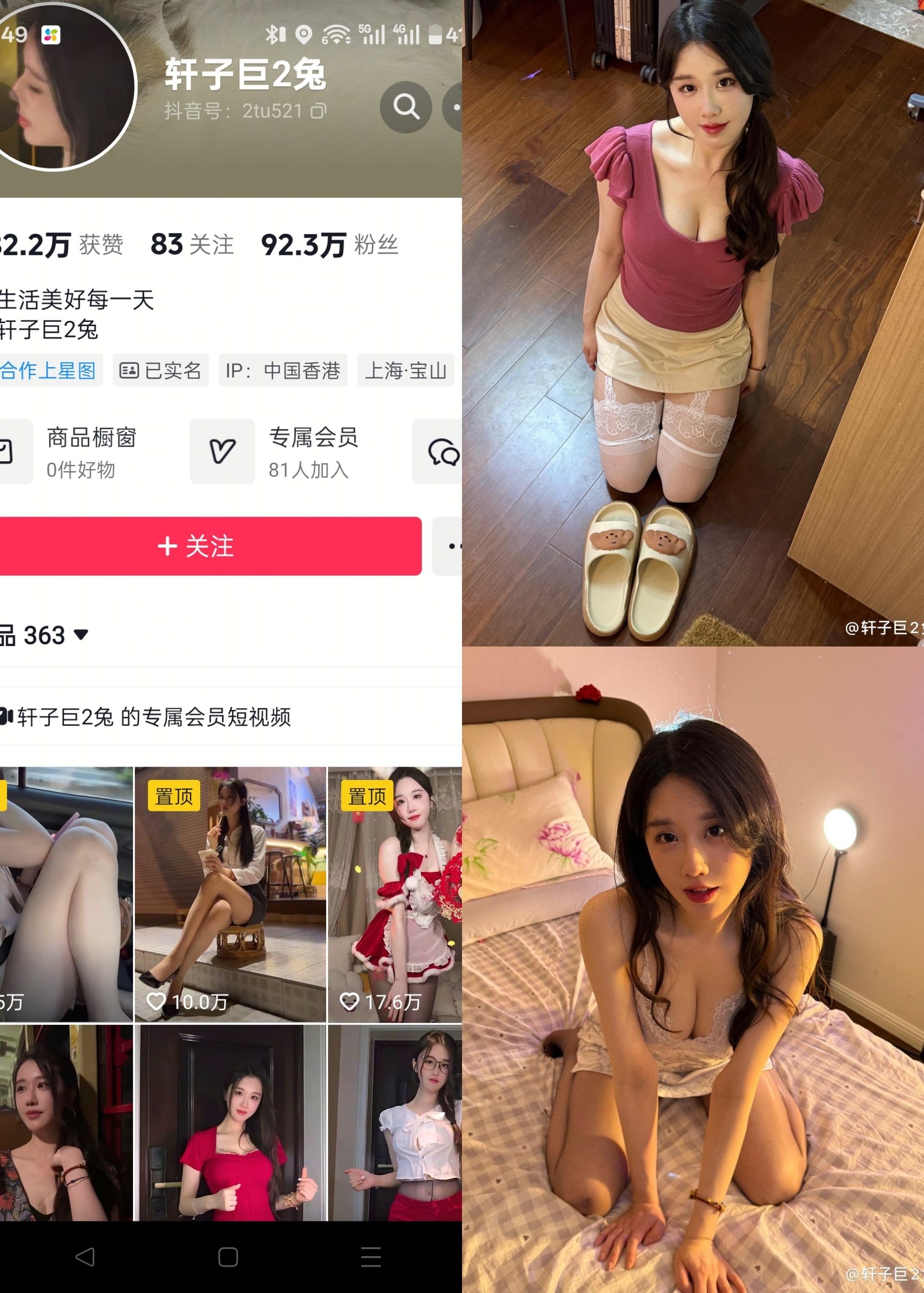 【抖音反差】轩子巨二兔-NO.039期 [19P]